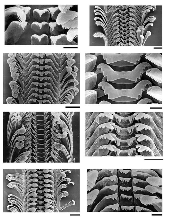 Collage aus Bildern von Radula, Zunge einer Schnecke