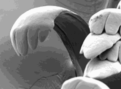 Radula, Zunge einer Schnecke