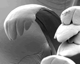 Radula, Zunge einer Schnecke